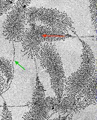 Electron micrograph showing transcription of ribosomal RNA genes.