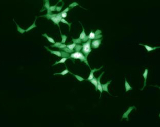 Green fluorescent neuronal cells.