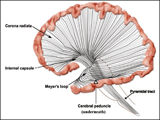 Drawing of the left hemisphere of the brain, including the outermost edge of the brain  connected by radiations of axons to the brainstem and spinal cord.